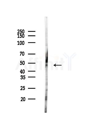 ECSIT Antibody - Western blot analysis of lysates from HepG2 cells(LPS, 4h treatment), using ECSIT Antibody at 1/1000 dilution.