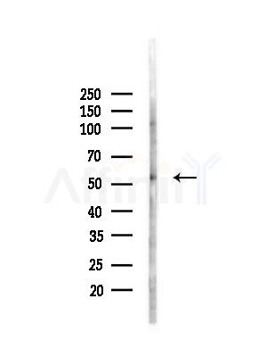 FOXF1 Antibody - Western blot analysis of lysates from PC12 cells(LPS, 4h treatment), using FOXF1 Antibody at 1/1000 dilution.