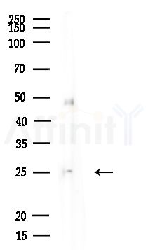 DIRAS3 Antibody - Western blot analysis of lysates from Rat liver, using DIRAS3 Antibody at 1/1000 dilution.
