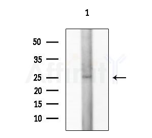 GEM Antibody - Western blot analysis of extracts from Rat testis, using GEM Antibody at 1/1000 dilution.