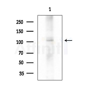 MCF2L Antibody - Western blot analysis of extracts from EC304 cells, using MCF2L Antibody at 1/1000 dilution.