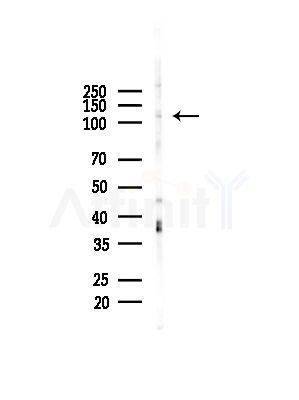 MCF2L Antibody - Western blot analysis of lysates from EC304 cells, using MCF2L Antibody at 1/1000 dilution.