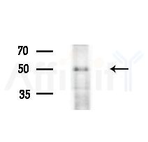 LRRC42 Antibody - Western blot analysis of extracts from EC304 cells
(heat-shock treatment), using LRRC42 Antibody at 1/1000 dilution.