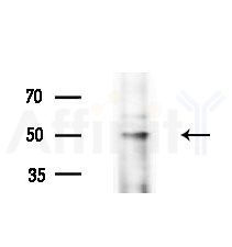 LRRC42 Antibody - Western blot analysis of extracts from Rat liver, using LRRC42 Antibody at 1/1000 dilution.