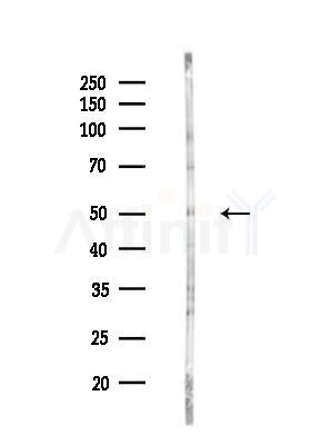 LRRC42 Antibody - Western blot analysis of lysates from EC304 cells(heat-shock treatment), using LRRC42 Antibody at 1/1000 dilution.