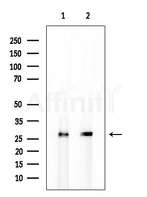 SLC25A27 Antibody - Western blot analysis of extracts from HUVEC cells Rat testis, using SLC25A27 Antibody at 1/1000 dilution.