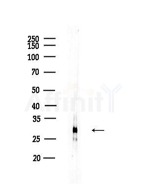 SLC25A27 Antibody - Western blot analysis of lysates from HUVEC cells, using SLC25A27 Antibody at 1/1000 dilution.