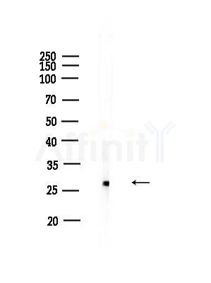 SLC25A27 Antibody - Western blot analysis of lysates from Rat testis, using SLC25A27 Antibody at 1/1000 dilution.