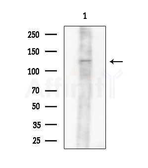 MYO1F Antibody - Western blot analysis of extracts from 3T3-L1 P6(heat-shock treatment), using MYO1F Antibody at 1/1000 dilution.