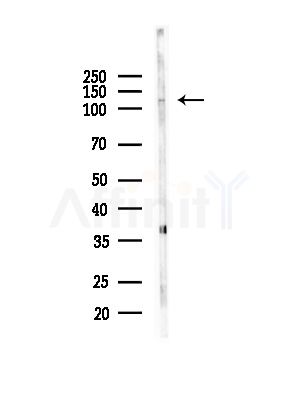 MYO1F Antibody - Western blot analysis of lysates from 3T3-L1 P6(heat-shock,45min treatment), using MYO1F Antibody at 1/1000 dilution.