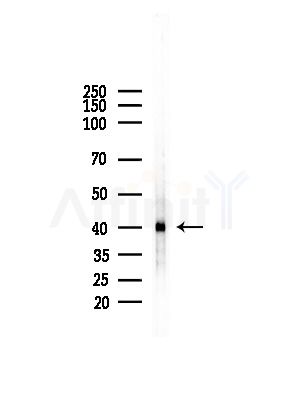 NDUFA10 Antibody - Western blot analysis of lysates from EC304 cells, using NDUFA10 Antibody at 1/1000 dilution.