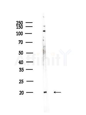 NDUFB6 Antibody - Western blot analysis of lysates from HUVEC cells, using NDUFB6 Antibody at 1/1000 dilution.