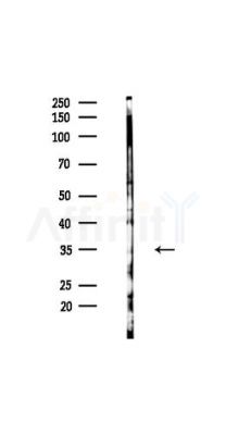 NEUROD6 Antibody - Western blot analysis of lysates from HUVEC cells(UV,30min treatment), using NEUROD6 Antibody at 1/1000 dilution.