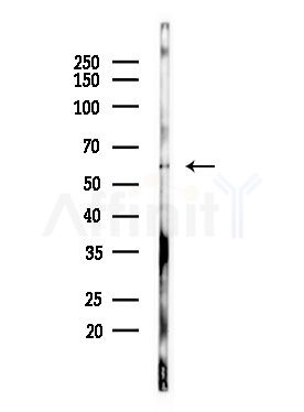 NOC4L Antibody - Western blot analysis of lysates from LoVo cells(heat-shock,45min treatment), using NOC4L Antibody at 1/1000 dilution.