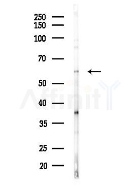 NOC4L Antibody - Western blot analysis of lysates from MDA-MB-231 cells(heat-shock,45min treatment), using NOC4L Antibody at 1/1000 dilution.