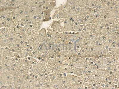 ATP12A Antibody - DF2223 at 1/100 staining human normal liver tissue by IHC-P.