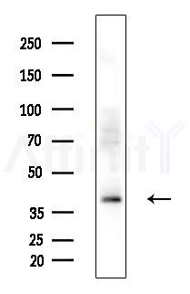 PDHA2 Antibody - Western blot analysis of extracts from Mouse liver, using PDHA2 Antibody at 1/1000 dilution.