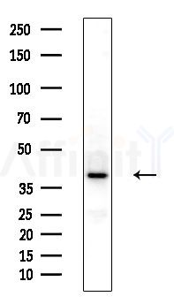 PDHA2 Antibody - Western blot analysis of extracts from Hela cells(heat-shock,45min treatment), using PDHA2 Antibody at 1/1000 dilution.