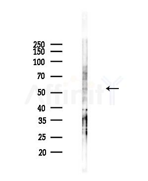 SEPT10 Antibody - Western blot analysis of lysates from Hela cells(heat-shock,45min treatment), using SEPT10 Antibody at 1/1000 dilution.