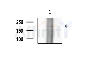 SCN3A Antibody - Western blot analysis of extracts from Mouse brain, using SCN3A Antibody at 1/1000 dilution.
