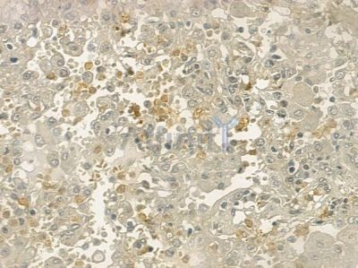 SCN3A Antibody - DF2241 at 1/100 staining human normal lung tissue by IHC-P.