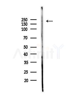 SCN3A Antibody - Western blot analysis of lysates from Mouse brain, using SCN3A Antibody at 1/1000 dilution.