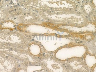 SLC34A2 Antibody - DF2244 at 1/100 staining human normal kidney tissue by IHC-P.