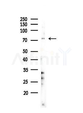SLC34A2 Antibody - Western blot analysis of lysates from COLO205 cells(heat-shock,45min treatment), using SLC34A2 Antibody at 1/1000 dilution.