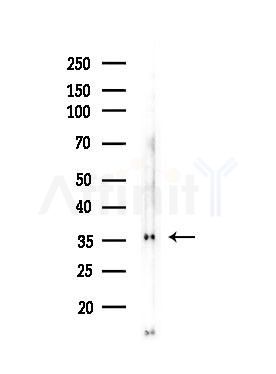 GPSN2 Antibody - Western blot analysis of lysates from COLO205 cells(heat-shock,45min treatment), using GPSN2 Antibody at 1/1000 dilution.