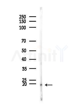 TCAP Antibody - Western blot analysis of lysates from Mouse testis, using TCAP Antibody at 1/1000 dilution.