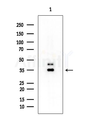 VGLL2 Antibody - Western blot analysis of extracts from COLO205 cells(heat-shock treatment), using VGLL2 Antibody at 1/1000 dilution.