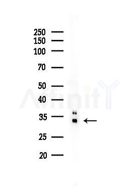 VGLL2 Antibody - Western blot analysis of lysates from COLO205 cells(heat-shock,45min treatment), using VGLL2 Antibody at 1/1000 dilution.