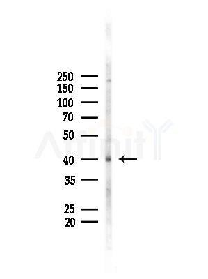 EIF2B2 Antibody - Western blot analysis of lysates from B16F10-LUC cells(LPS, 4h treatment), using EIF2B2 Antibody at 1/1000 dilution.