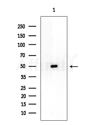 TSEN2 Antibody - Western blot analysis of extracts from Mouse testis, using TSEN2 Antibody at 1/1000 dilution.