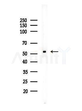 TSEN2 Antibody - Western blot analysis of lysates from Mouse testis, using TSEN2 Antibody at 1/1000 dilution.