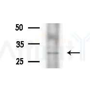 TNNT3 Antibody - Western blot analysis of extracts from A375 cells(heat-shock,45min treatment), using TNNT3 Antibody at 1/1000 dilution.