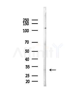 TNNT3 Antibody - Western blot analysis of lysates from A375 cells(heat-shock,45min treatment), using TNNT3 Antibody at 1/1000 dilution.