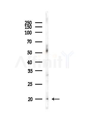 UBE2D3 Antibody - Western blot analysis of lysates from RAW264.