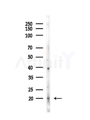 UBE2R2 Antibody - Western blot analysis of lysates from HepG2 cells(LPS,4h treatment), using UBE2R2 Antibody at 1/1000 dilution.