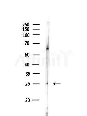 ATP6V1D Antibody - Western blot analysis of lysates from Rat lung, using ATP6V1D Antibody at 1/1000 dilution.