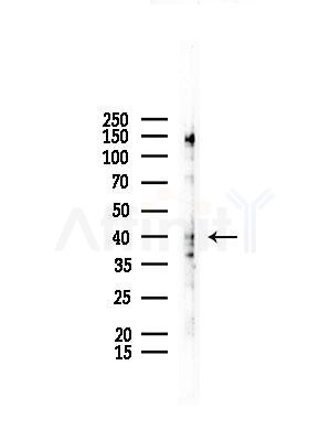 CACNG8 Antibody - Western blot analysis of lysates from COLO205 cells, using CACNG8 Antibody at 1/1000 dilution.