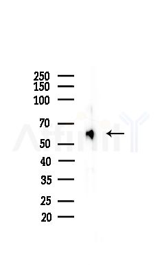 CACNB4 Antibody - Western blot analysis of lysates from Mouse brain, using CACNB4 Antibody at 1/1000 dilution.