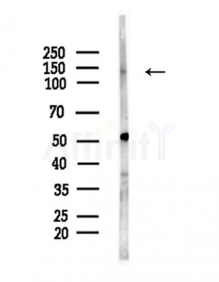 ADCY8 Antibody - Western blot analysis of lysates from COLO205 cells(heat-shock,45min treatment), using ADCY8 Antibody at 1/1000 dilution.