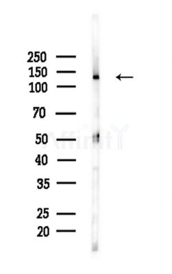 ADCY8 Antibody - Western blot analysis of lysates from Mouse brain, using ADCY8 Antibody at 1/1000 dilution.