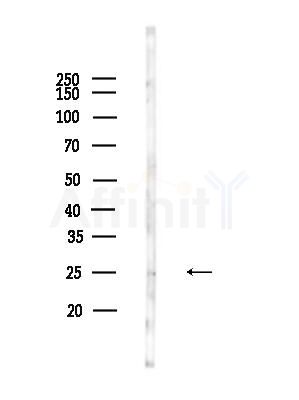 APR3 Antibody - Western blot analysis of lysates from Mouse liver, using APR3 Antibody at 1/1000 dilution.