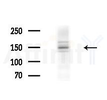 ASPP2 Antibody - Western blot analysis of extracts from EC304 cells
(heat-shock treatment), using ASPP2 Antibody at 1/1000 dilution.