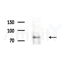 CDH12 Antibody - Western blot analysis of extracts from HUVEC cells(LPS,4h treatment), using CDH12 Antibody at 1/1000 dilution.