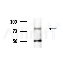 CDH12 Antibody - Western blot analysis of extracts from LoVo cells(heat-shock,45min treatment), using CDH12 Antibody at 1/1000 dilution.