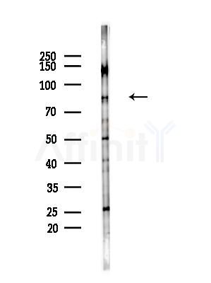CDH12 Antibody - Western blot analysis of lysates from LoVo cells(heat-shock,45min treatment), using CDH12 Antibody at 1/1000 dilution.