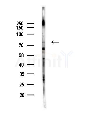 CDH12 Antibody - Western blot analysis of lysates from HUVEC cells(LPS,4h treatment), using CDH12 Antibody at 1/1000 dilution.